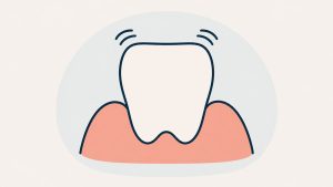 すり減って揺れを示す咬耗した歯のイラスト