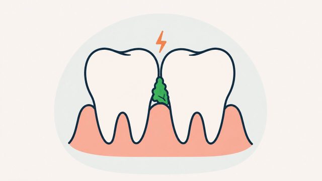 歯と歯の間に食べ物が挟まったイラスト