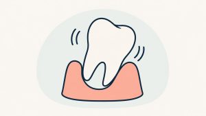 歯茎の中でぐらぐらと揺れる歯のイラスト