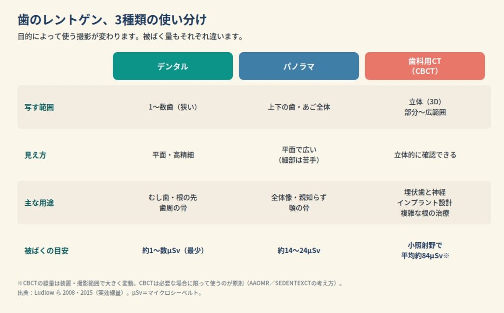 歯のレントゲン3種類の使い分け比較表。写す範囲・見え方・主な用途・被ばくの目安を比較。デンタルは1〜数歯で約1〜数µSv、パノラマは全体で約14〜24µSv、CBCTは立体で小照射野平均約84µSv。