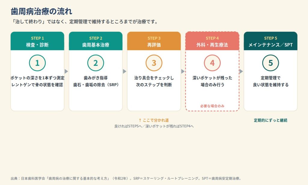 歯周病治療の流れ5ステップ。検査→歯周基本治療→再評価→(必要時)外科・再生療法→メインテナンス/SPT。