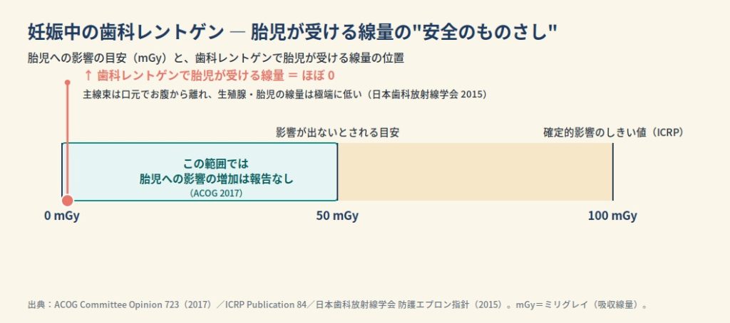 妊娠中の歯科レントゲンで胎児が受ける線量の安全のものさし。歯科レントゲンの胎児線量はほぼ0で、影響が出ないとされる目安50mGy(ACOG)や確定的影響のしきい値100mGy(ICRP)とは桁違いに小さいことを示した図。