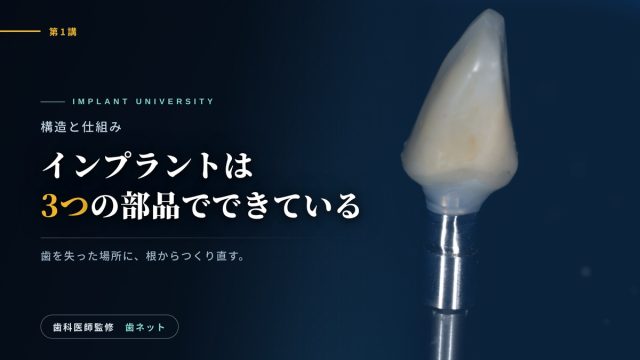 アバットメントに装着された前歯のクラウンのマクロ写真と、「インプラントは3つの部品でできている」の文字