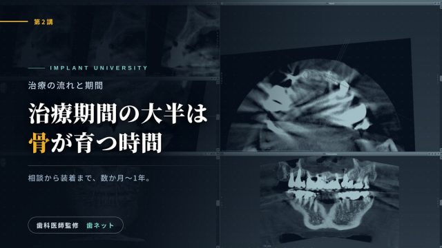 CBCTによるインプラントの治療計画画面と、「治療期間の大半は骨が育つ時間」の文字