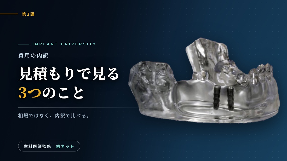 インプラントが2本入った下顎骨模型の写真と、「見積もりで見る3つのこと」の文字が入った第3講のアイキャッチ