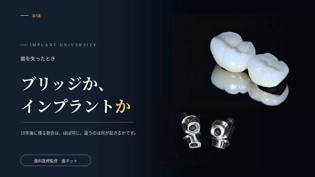 濃紺の背景に、セラミックのクラウンとインプラントのアバットメントを並べた写真。第4講「ブリッジか、インプラントか」のアイキャッチ