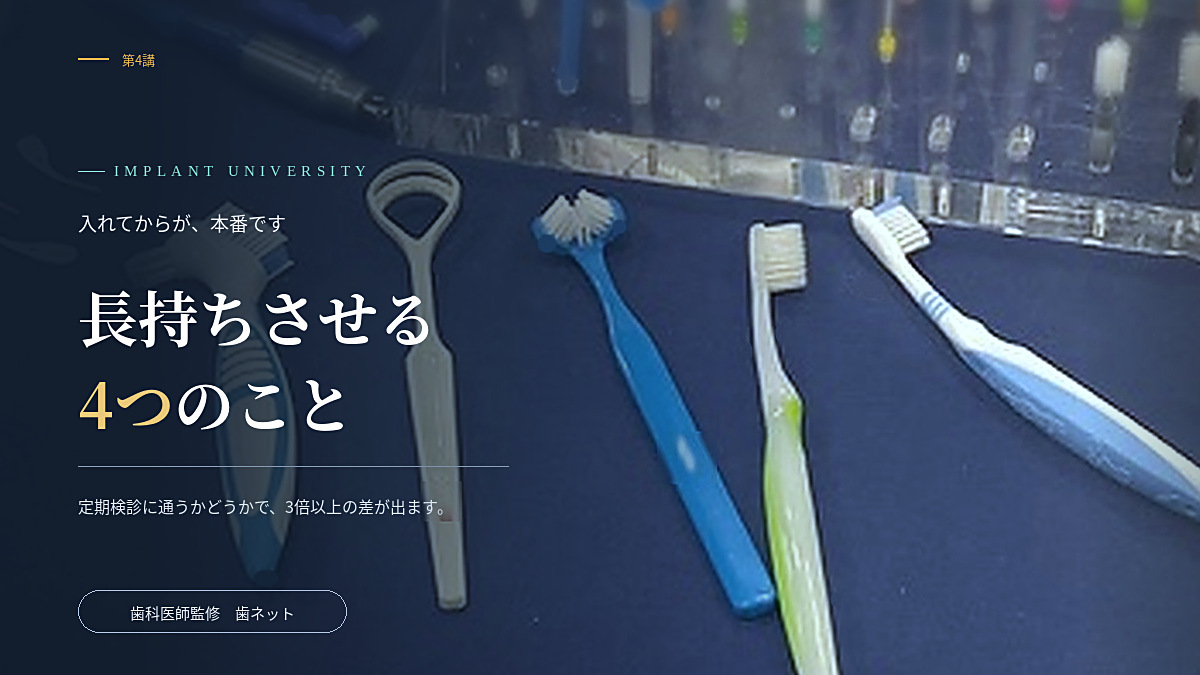 歯間ブラシ・舌ブラシ・歯ブラシなどのメインテナンス用具と、「長持ちさせる4つのこと」の文字