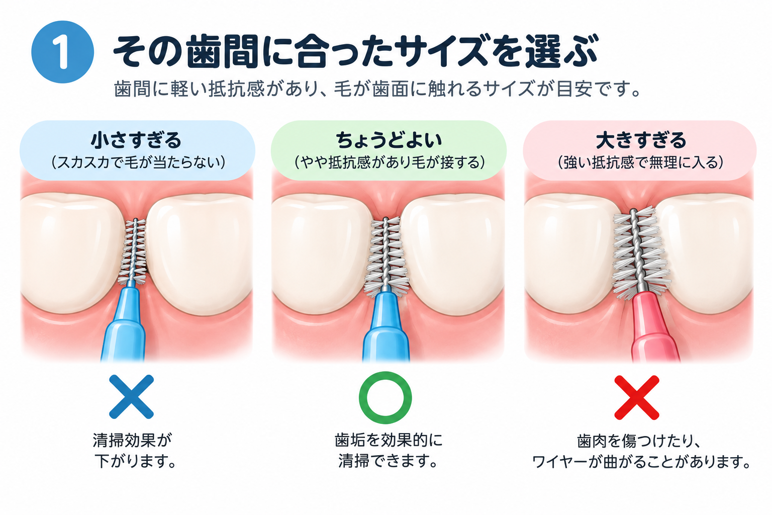 歯間ブラシが小さすぎる場合、歯間に合う場合、大きすぎる場合の比較