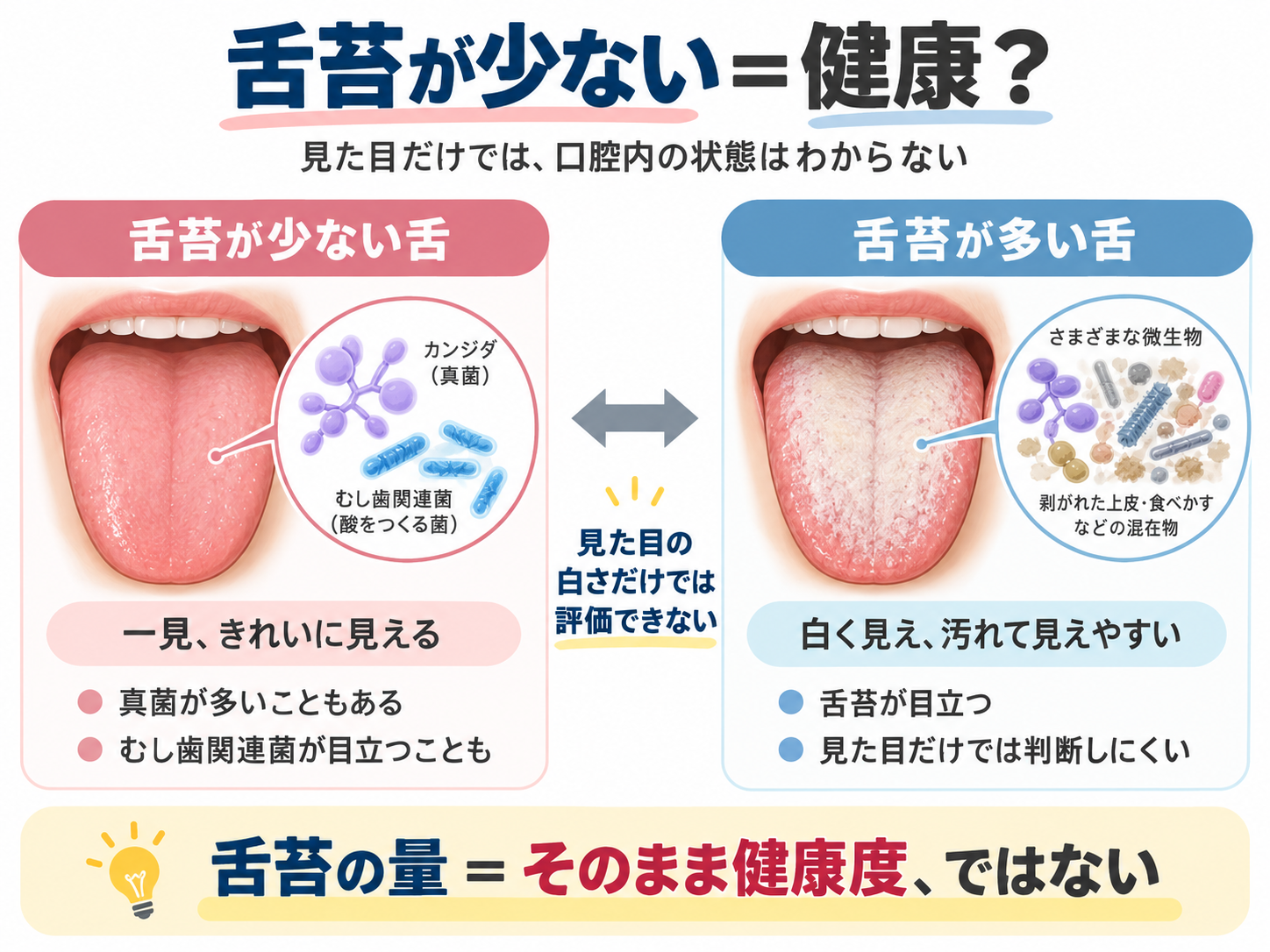 舌苔が少ない舌と舌苔が多い舌を比較し、見た目だけでは口腔内の状態はわからないことを示した図
